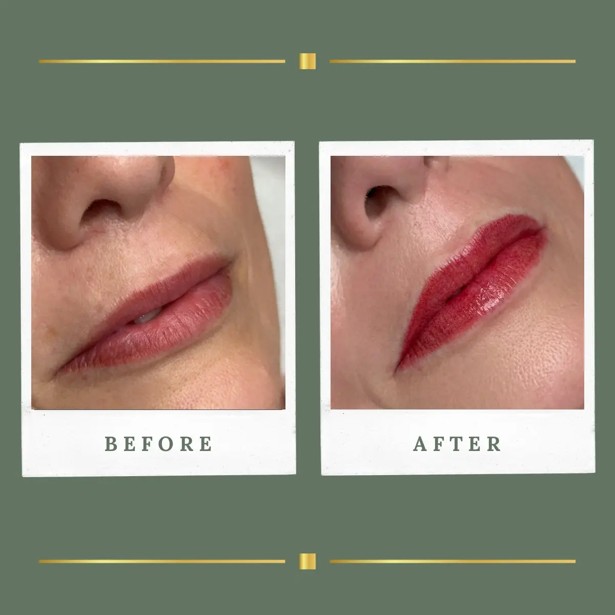 Soft natural lip blush before and after, Farnsfield clinic