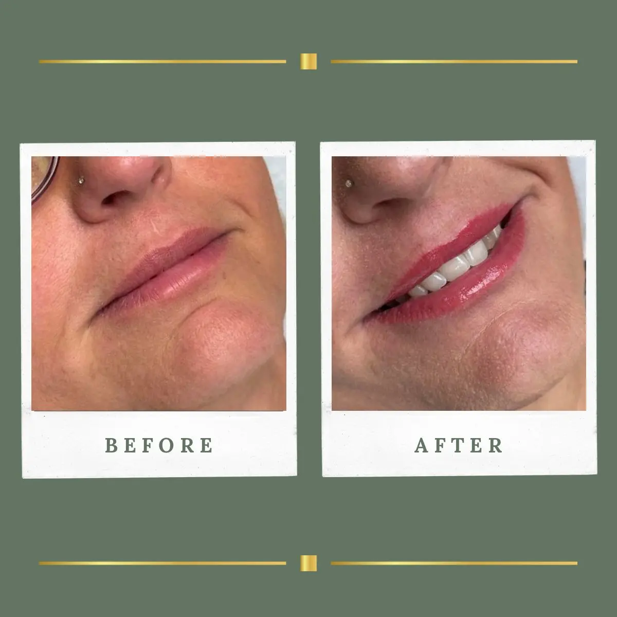Lip blush permanent makeup smile result at Rachel Aesthetics