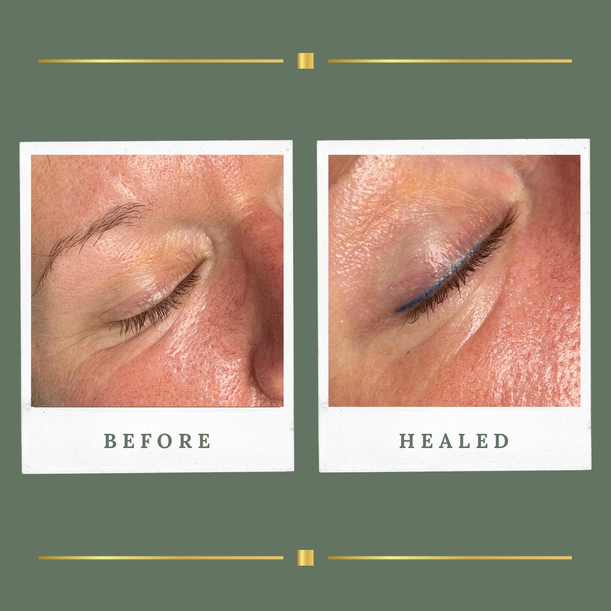 Before and healed classic eyeliner permanent makeup result at Rachel Aesthetics