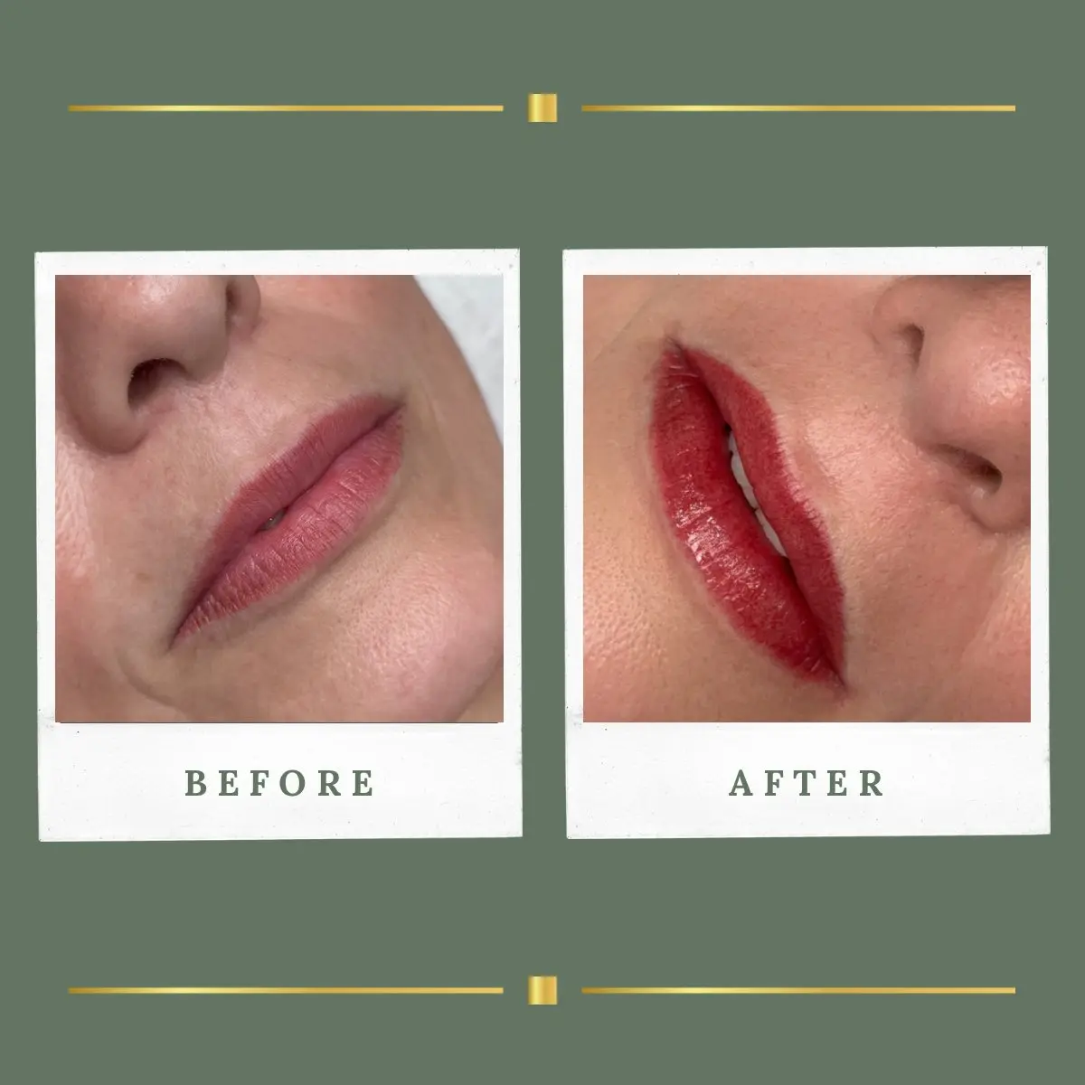 Permanent lip colour restoring definition to the lip border, Rachel Aesthetics