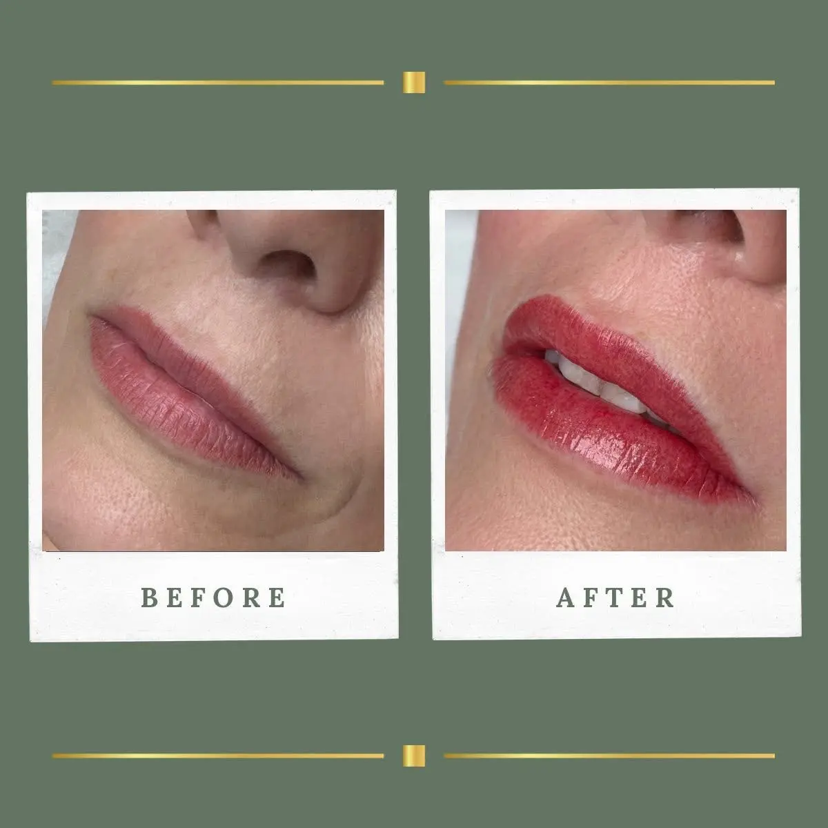Lip blush before and after from a side angle, Nottinghamshire