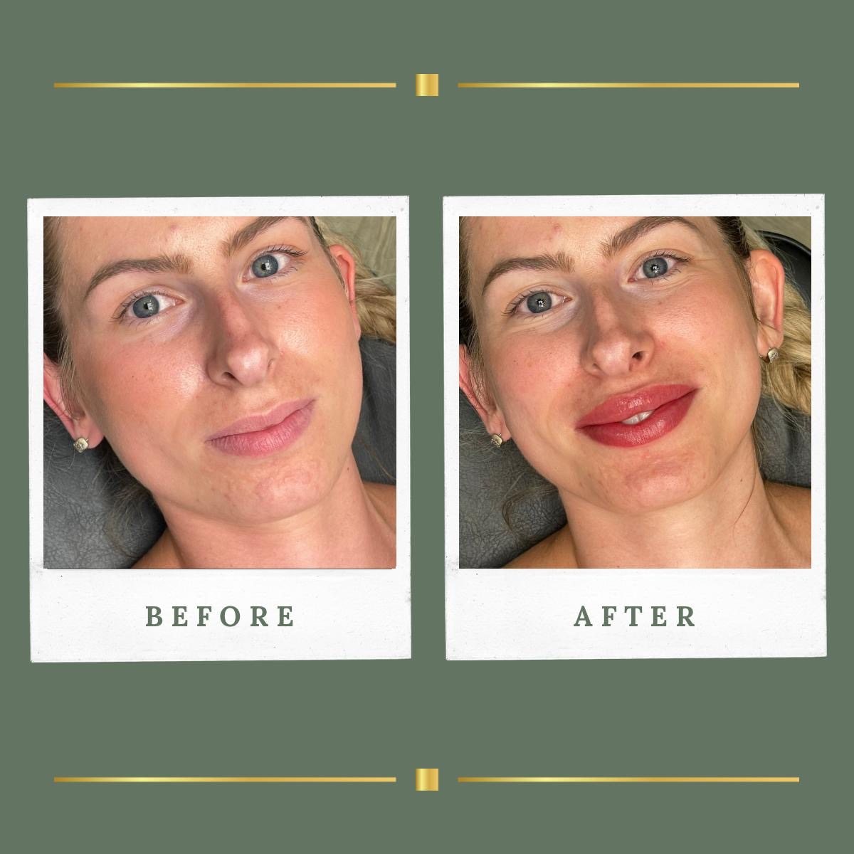 Lip blush permanent makeup before and after at Rachel Aesthetics, Farnsfield