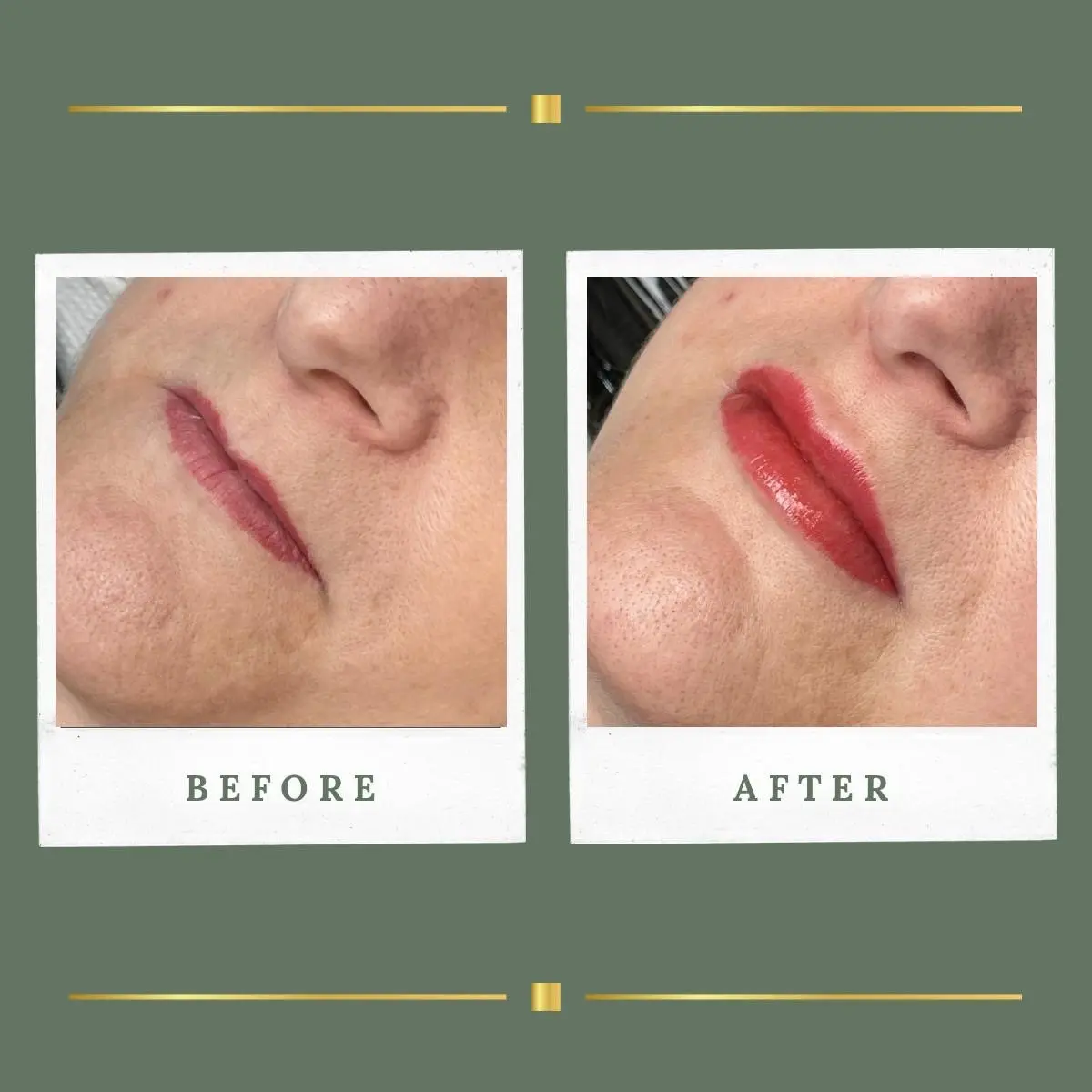 Permanent lip colour result on fine lip lines, Nottinghamshire
