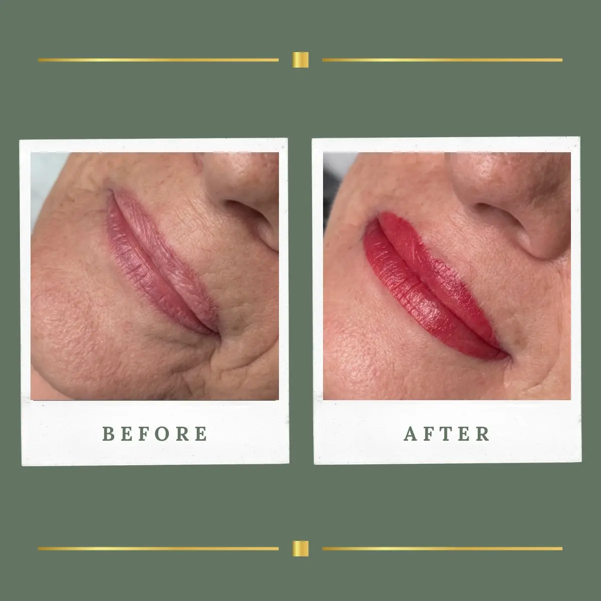 Soft natural lip blush before and after, Farnsfield clinic