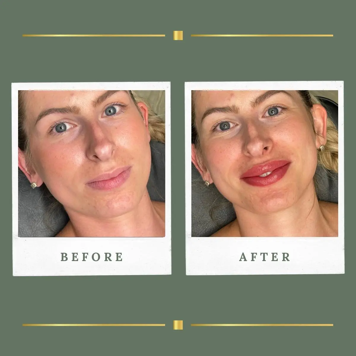 Lip blush permanent makeup before and after at Rachel Aesthetics Farnsfield