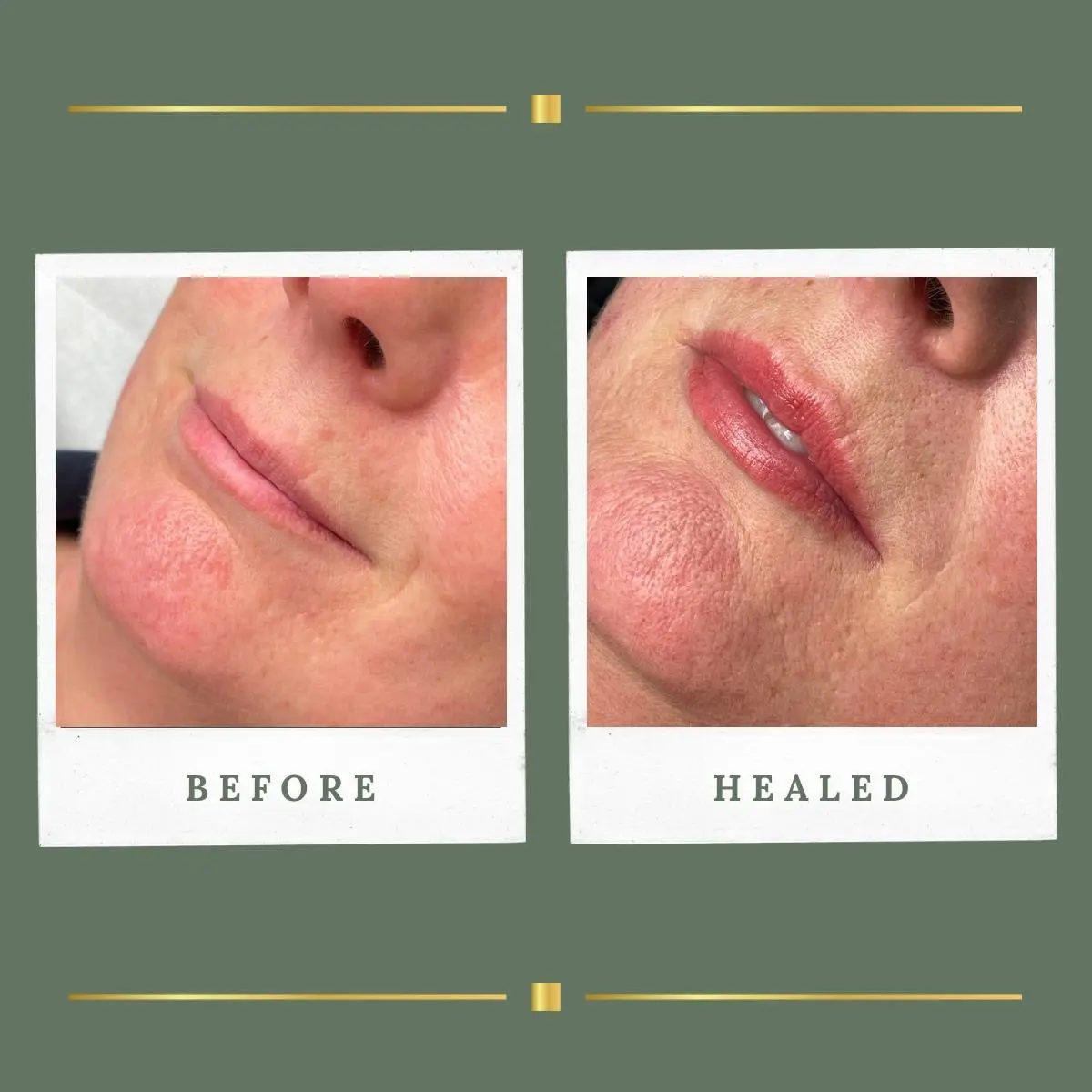 Healed lip blush in a natural pink tone at Rachel Aesthetics