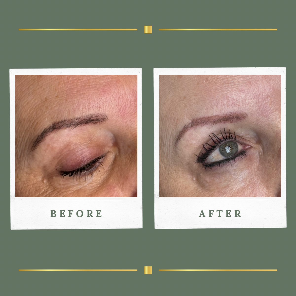 Brow permanent makeup removal before and after result for a client from Mansfield