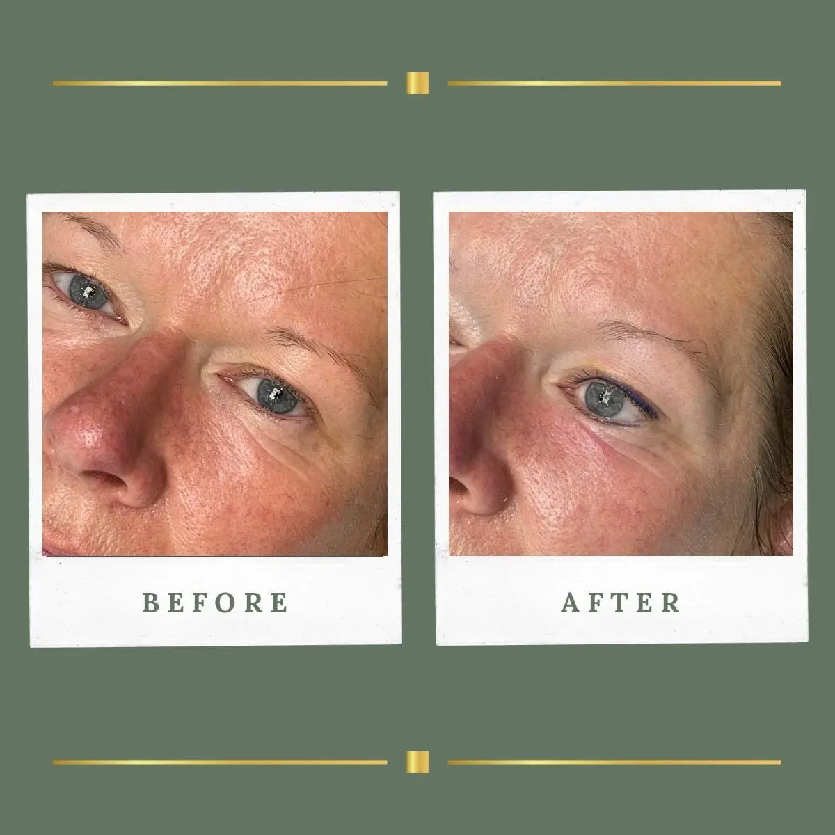 Coloured blue permanent eyeliner result, Nottinghamshire