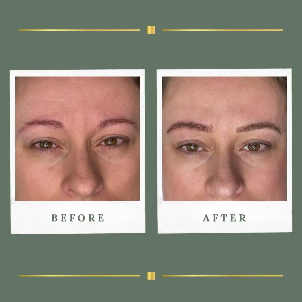 Soft brow permanent makeup result on fine brows, Farnsfield clinic