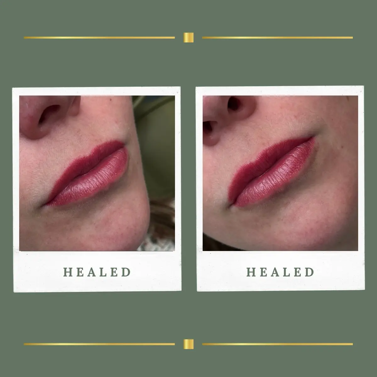 Healed lip blush restoring natural lip colour, Nottinghamshire