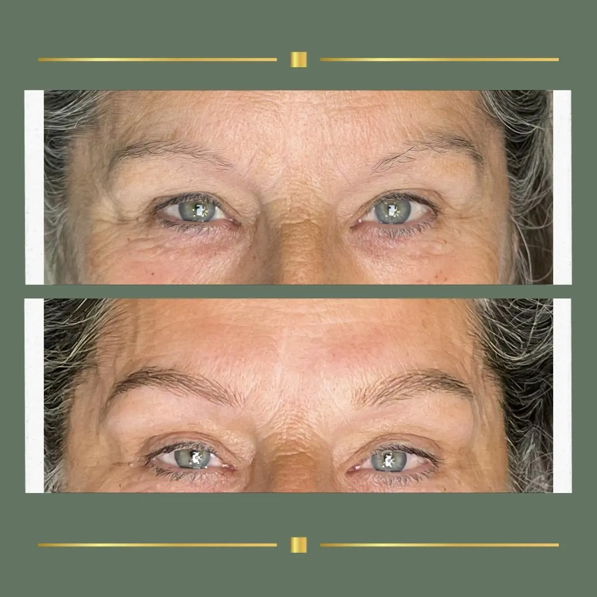 Brow permanent makeup before and after on an older client at Rachel Aesthetics, Nottinghamshire