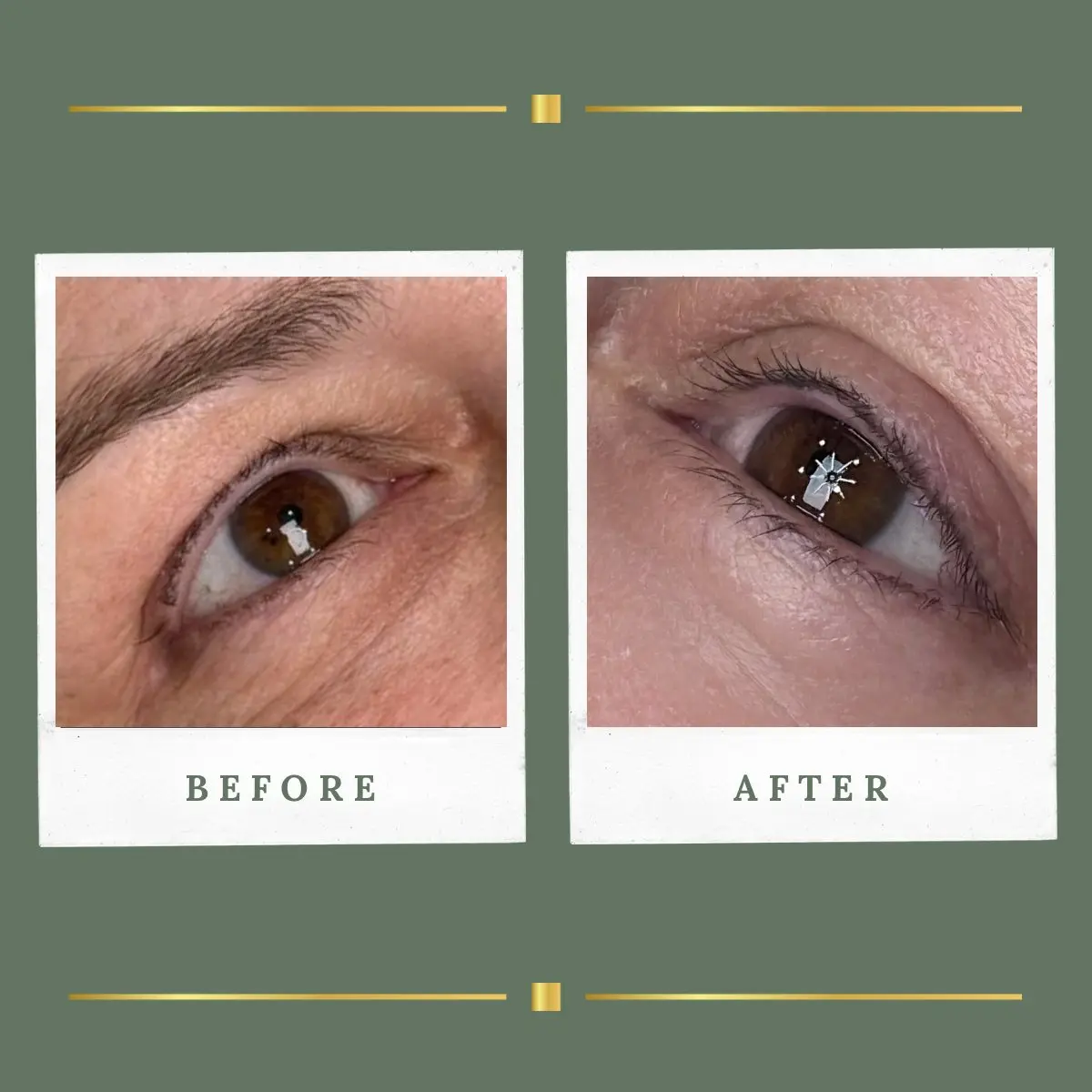 Lash enhancement healed result, Farnsfield