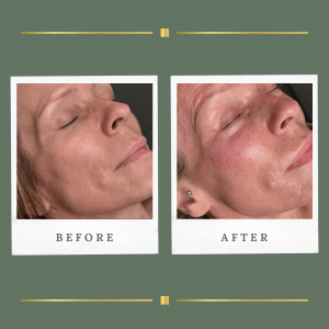 Korean Facial Glass Skin Nottinghamshire