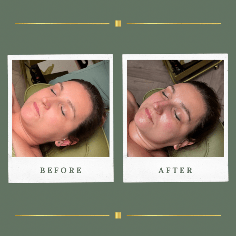 Korean Facial Treatment Nottinghamshire