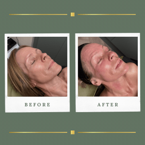 Korean Facials Farnsfield | Luxury Skin Treatments